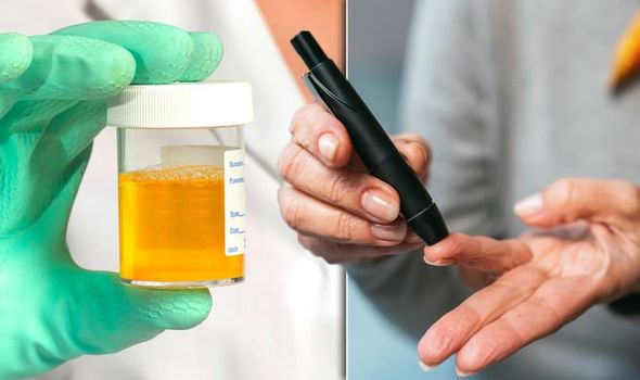 Why Do Patients With Uncontrolled Diabetes Experience Polyuria?