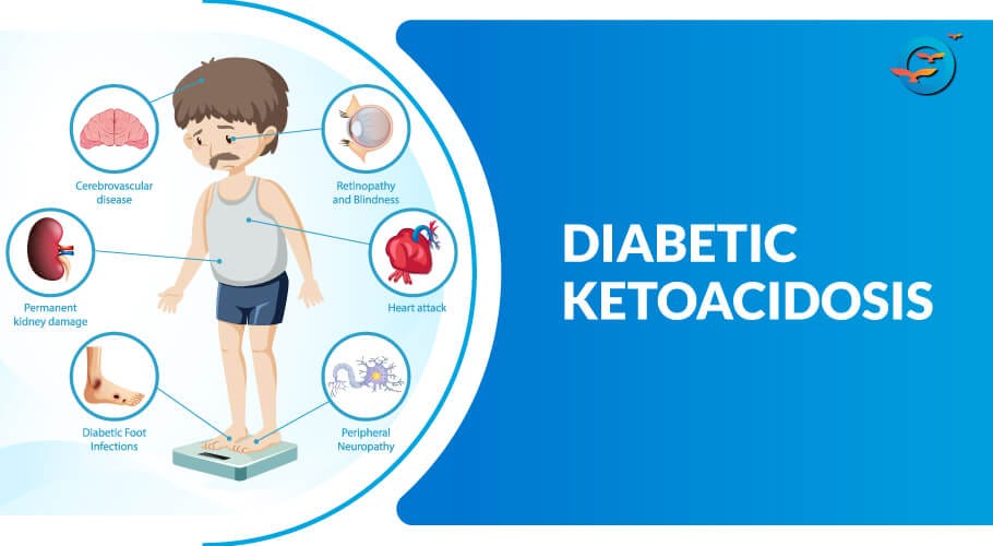 Recovering From Diastic Ketoacidosis: Your Step-by-Step Healing Guide